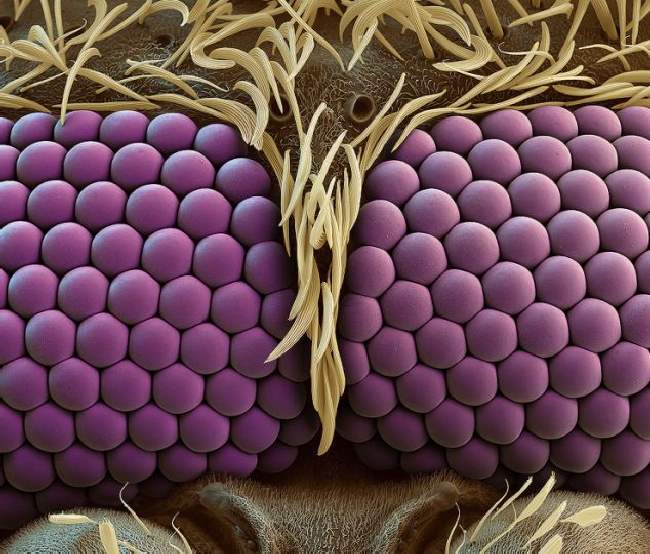 Microscopic Winners