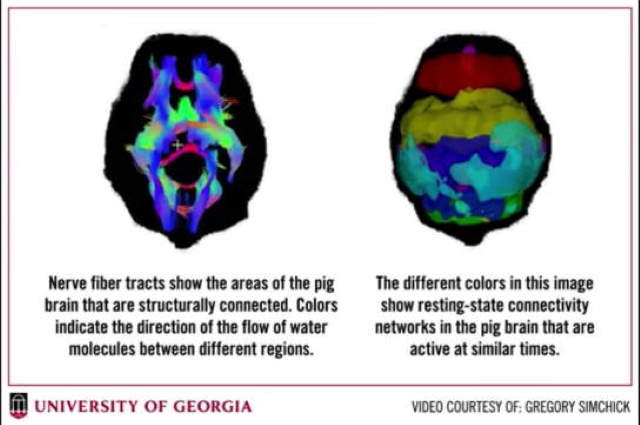 Shangrala's Recent Brain Discoveries